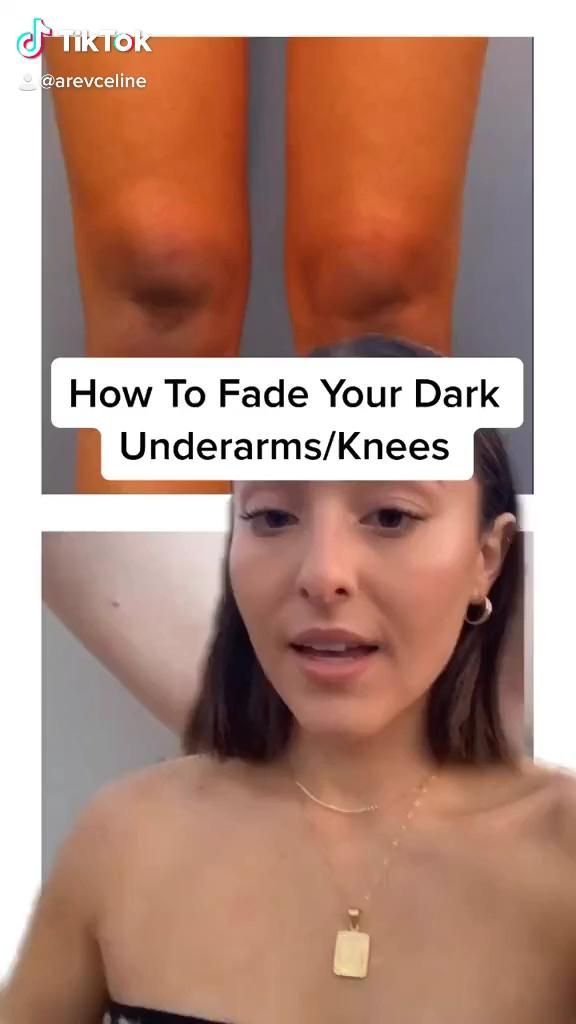 How To Fade Dark Underarms/Knees -   15 how to get rid of dark underarms ideas
