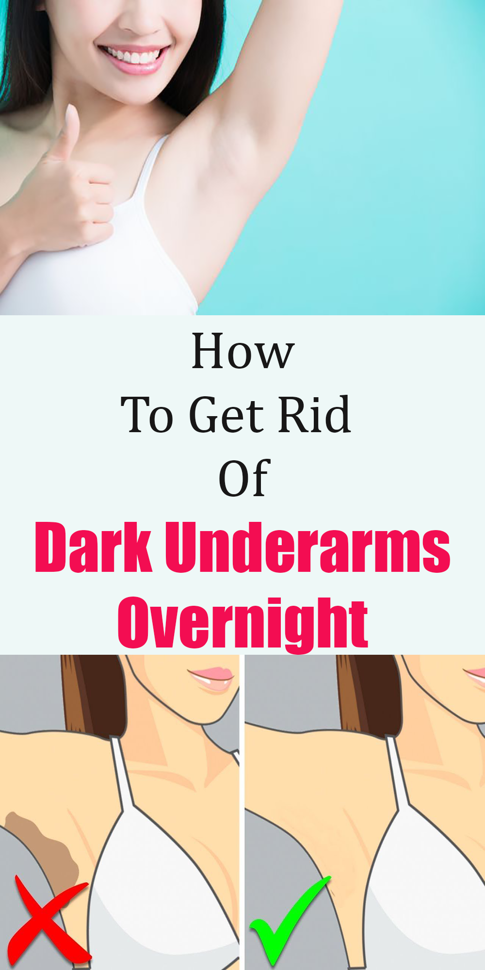 How to get rid of Dark underarms overnight -   15 how to get rid of dark underarms ideas