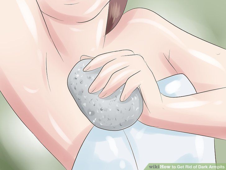 How to Get Rid of Dark Armpits: 12 Steps (with Pictures) -   15 how to get rid of dark underarms ideas