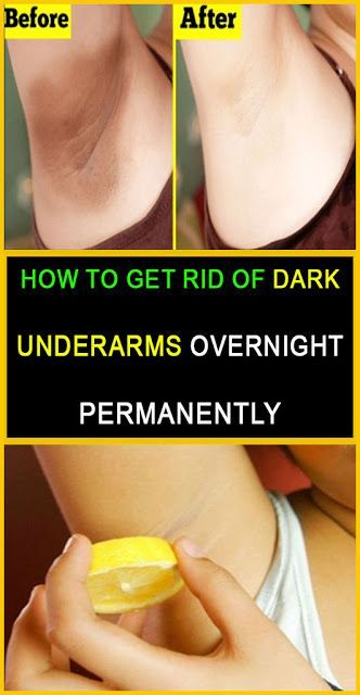 How to Get Rid of Dark Underarms Overnight Permanently -   15 how to get rid of dark underarms ideas