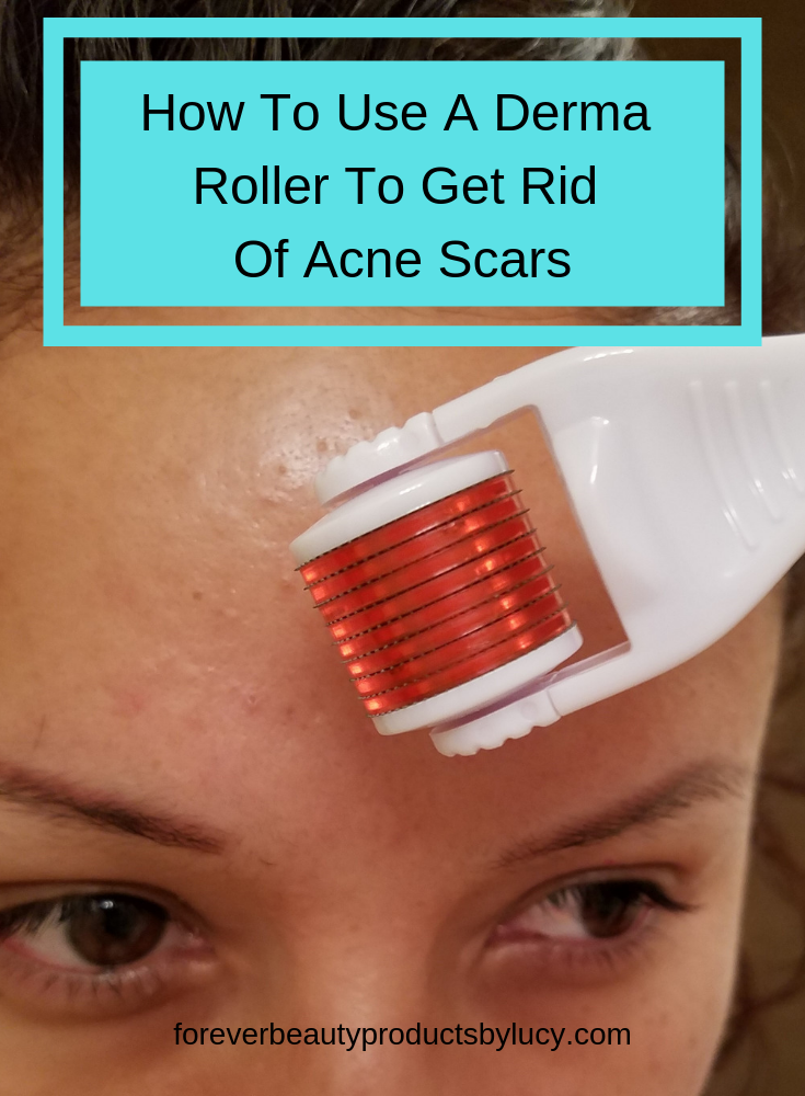 How To Use A Derma Roller For Acne Scars - Forever Beauty Products by Lucy -   18 how to get rid of acne scars ideas