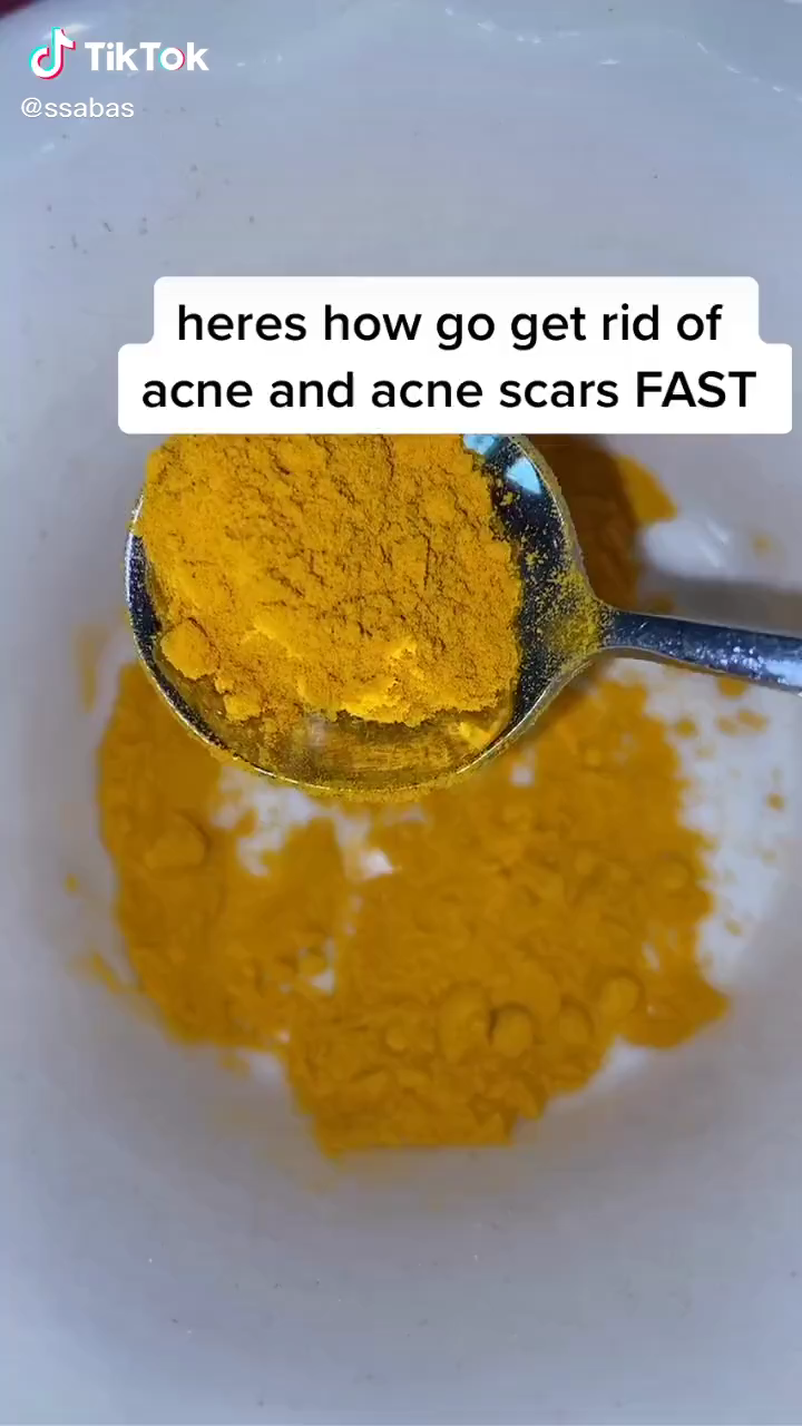 18 how to get rid of acne scars ideas